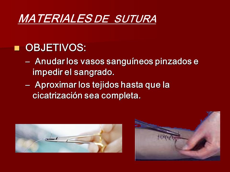 MATERIALES DE SUTURA OBJETIVOS: