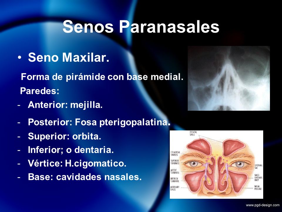 Senos Paranasales Seno Maxilar. Forma de pirámide con base medial.