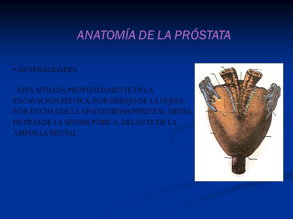 anatomia radiologica próstata)
