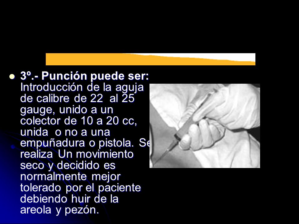 3º.- Punción puede ser: Introducción de la aguja de calibre de 22 al 25 gauge, unido a un colector de 10 a 20 cc, unida o no a una empuñadura o pistola.