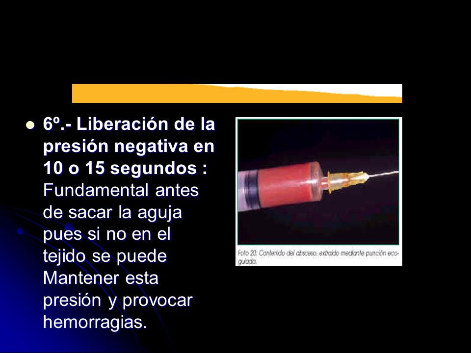 6º.- Liberación de la presión negativa en 10 o 15 segundos : Fundamental antes de sacar la aguja pues si no en el tejido se puede Mantener esta presión y provocar hemorragias.