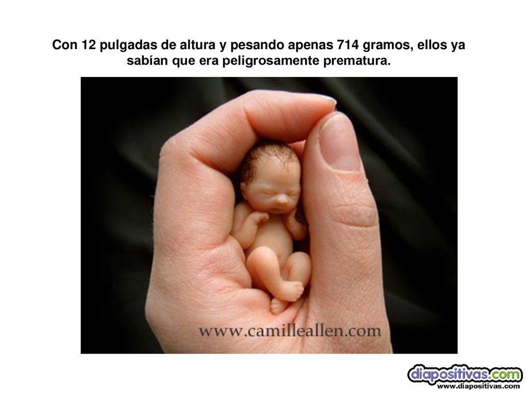 Con 12 pulgadas de altura y pesando apenas 714 gramos, ellos ya sabían que era peligrosamente prematura.