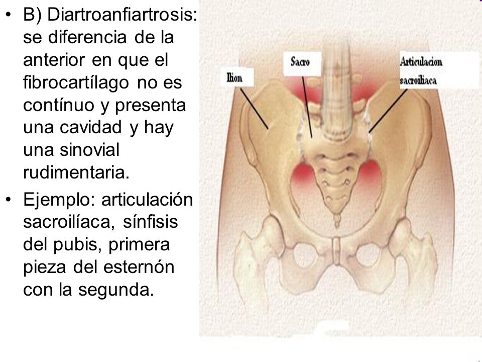 B) Diartroanfiartrosis: se diferencia de la anterior en que el fibrocartílago no es contínuo y presenta una cavidad y hay una sinovial rudimentaria.