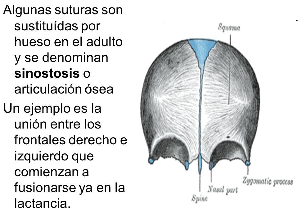 Algunas suturas son sustituídas por hueso en el adulto y se denominan sinostosis o articulación ósea