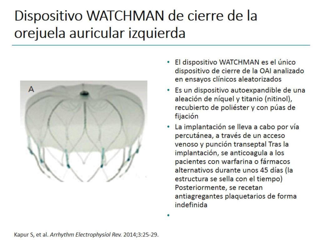 Dispositivo WATCHMAN de cierre de la orejuela auricular izquierda