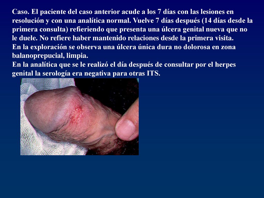 Caso. El paciente del caso anterior acude a los 7 días con las lesiones en resolución y con una analítica normal. Vuelve 7 días después (14 días desde la primera consulta) refieriendo que presenta una úlcera genital nueva que no le duele. No refiere haber mantenido relaciones desde la primera visita.