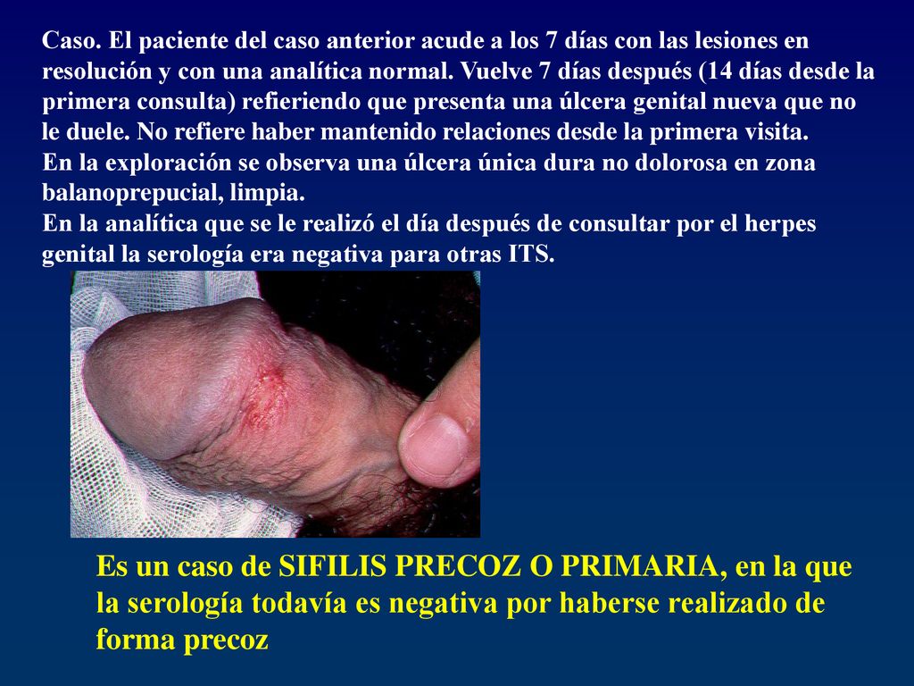 Caso. El paciente del caso anterior acude a los 7 días con las lesiones en resolución y con una analítica normal. Vuelve 7 días después (14 días desde la primera consulta) refieriendo que presenta una úlcera genital nueva que no le duele. No refiere haber mantenido relaciones desde la primera visita.