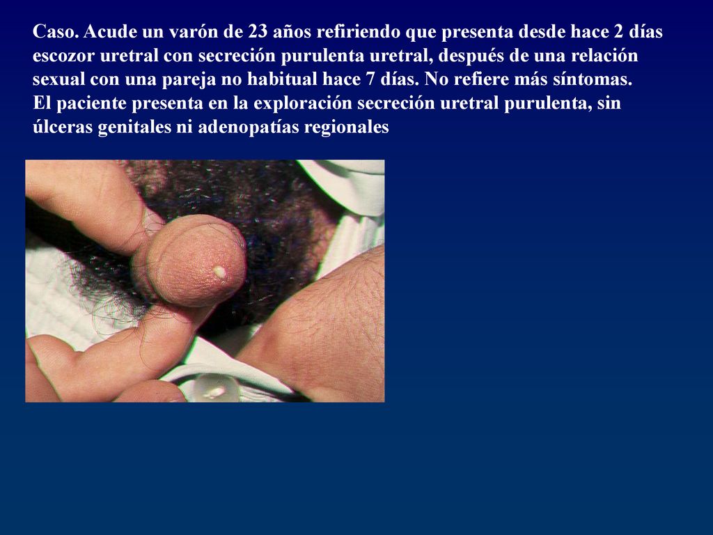 Caso. Acude un varón de 23 años refiriendo que presenta desde hace 2 días escozor uretral con secreción purulenta uretral, después de una relación sexual con una pareja no habitual hace 7 días. No refiere más síntomas.