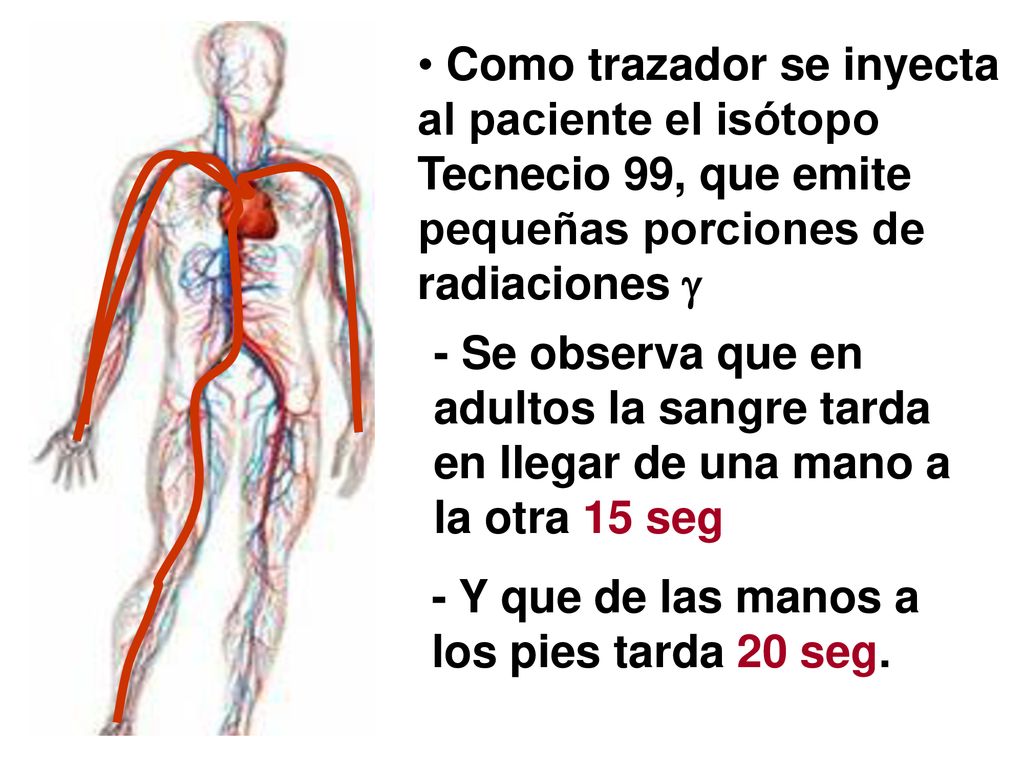 Como trazador se inyecta al paciente el isótopo Tecnecio 99, que emite pequeñas porciones de radiaciones 