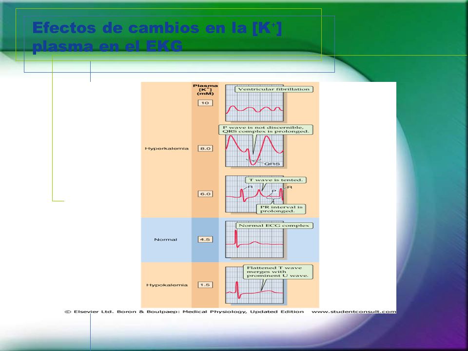 Efectos de cambios en la [K⁺] plasma en el EKG
