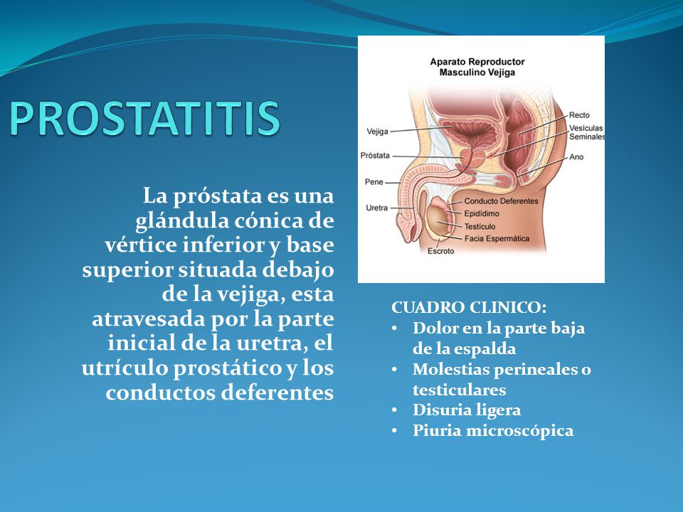 Prostatitis fun Netgis és prostatitis