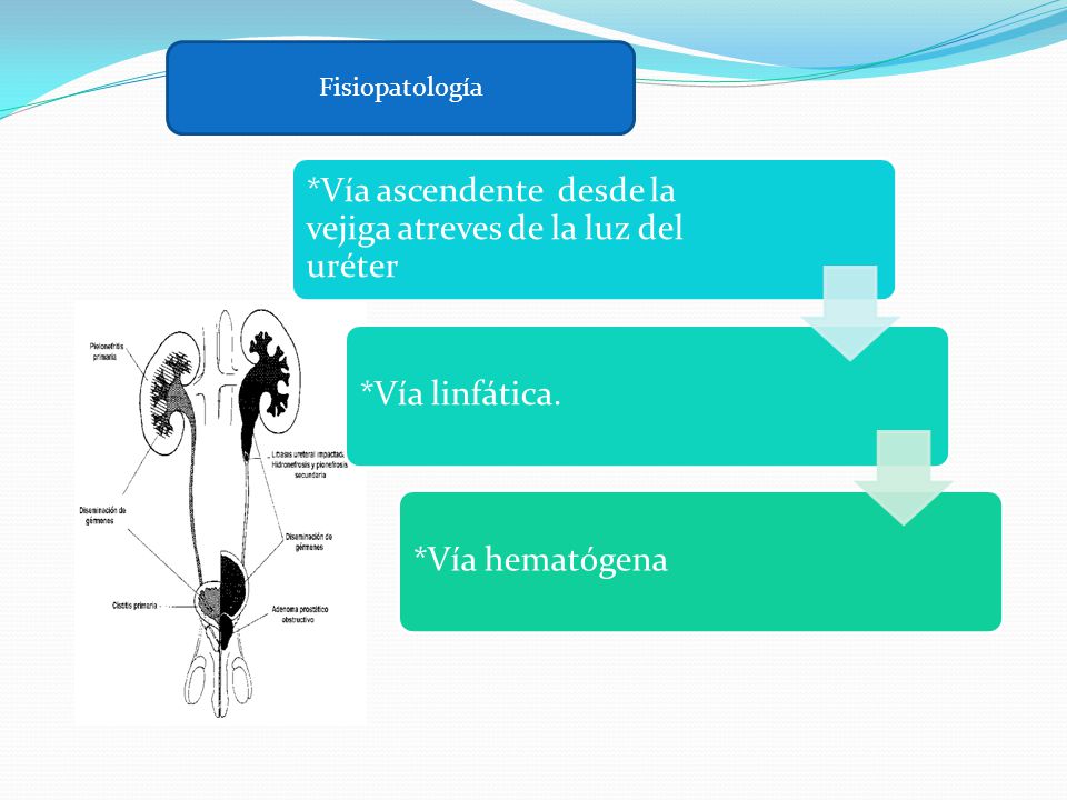 Fisiopatología *Vía ascendente desde la vejiga atreves de la luz del uréter.