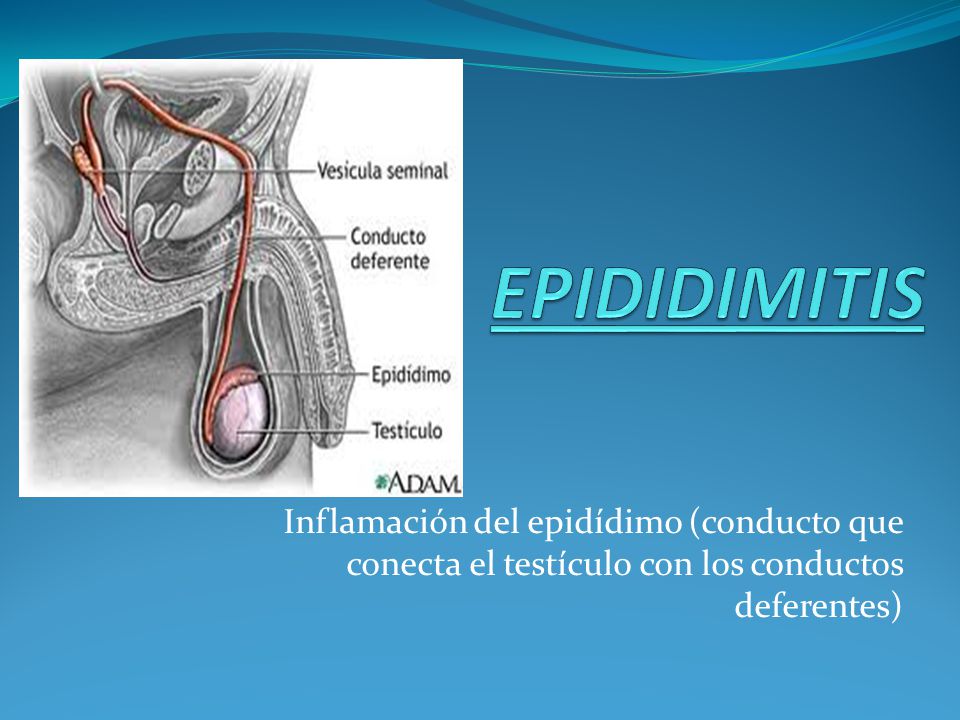 EPIDIDIMITIS Inflamación del epidídimo (conducto que conecta el testículo con los conductos deferentes)