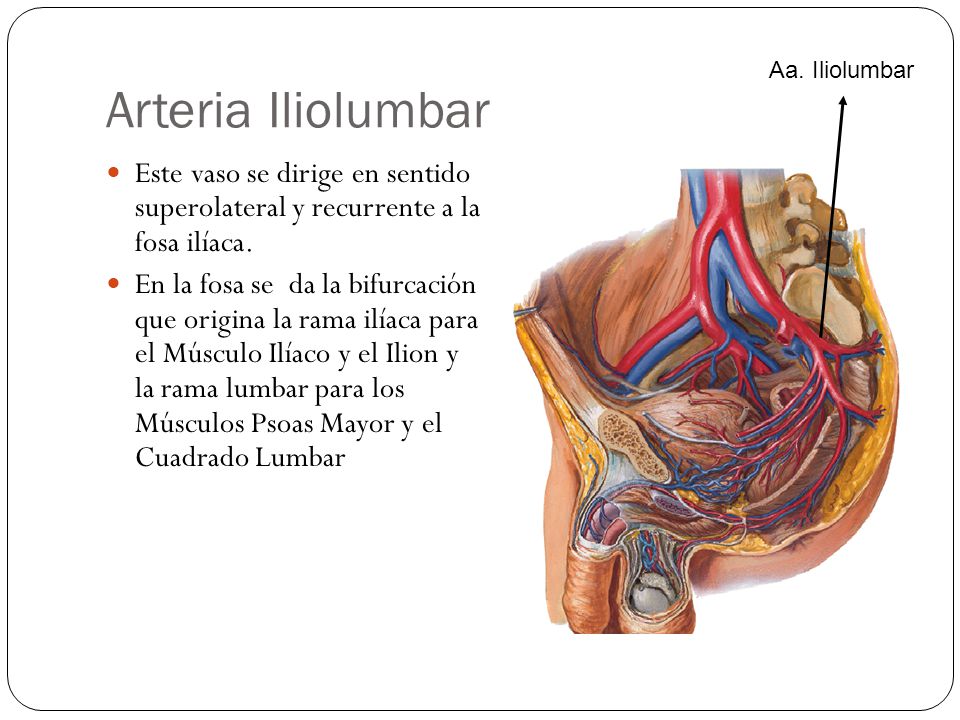 Arteria Iliolumbar Aa. Iliolumbar. Este vaso se dirige en sentido superolateral y recurrente a la fosa ilíaca.
