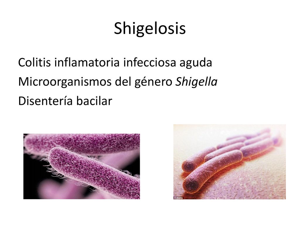 Shigelosis Colitis inflamatoria infecciosa aguda Microorganismos del género Shigella Disentería bacilar
