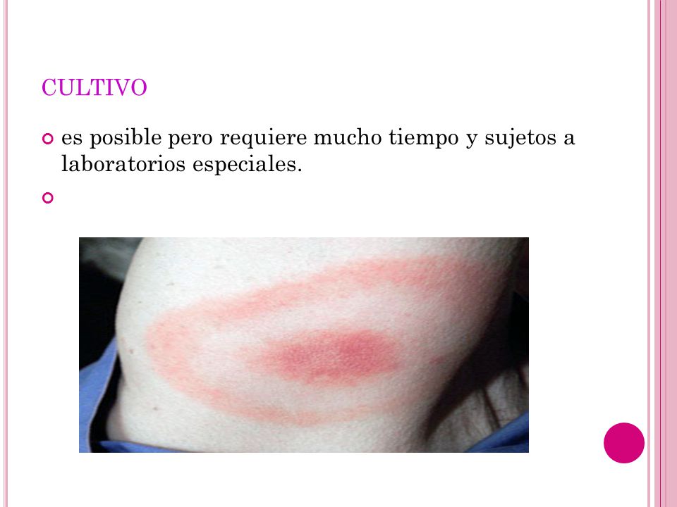 cultivo es posible pero requiere mucho tiempo y sujetos a laboratorios especiales.