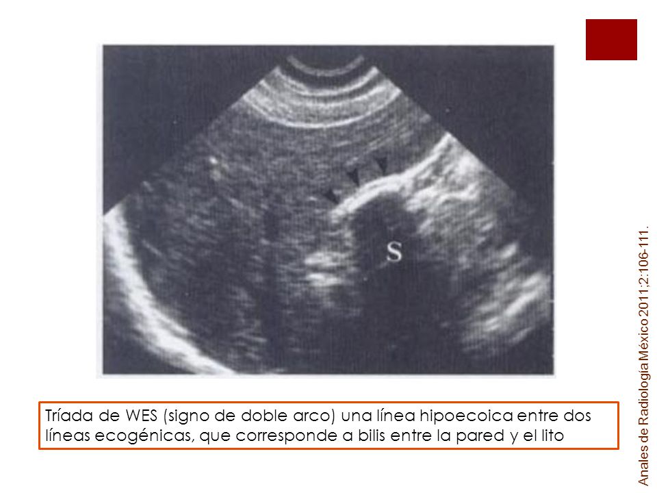 Anales de Radiología México 2011;2: