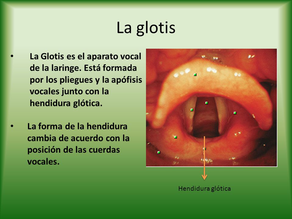 La glotis La Glotis es el aparato vocal de la laringe. Está formada por los pliegues y la apófisis vocales junto con la hendidura glótica.