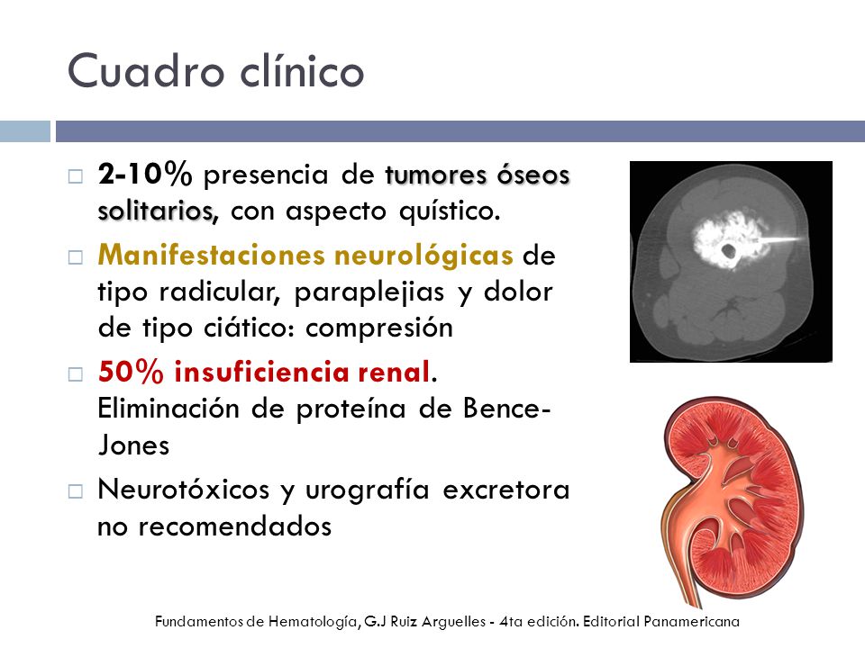 Cuadro clínico 2-10% presencia de tumores óseos solitarios, con aspecto quístico.