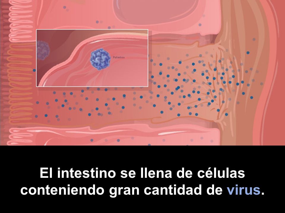 El intestino se llena de células conteniendo gran cantidad de virus.