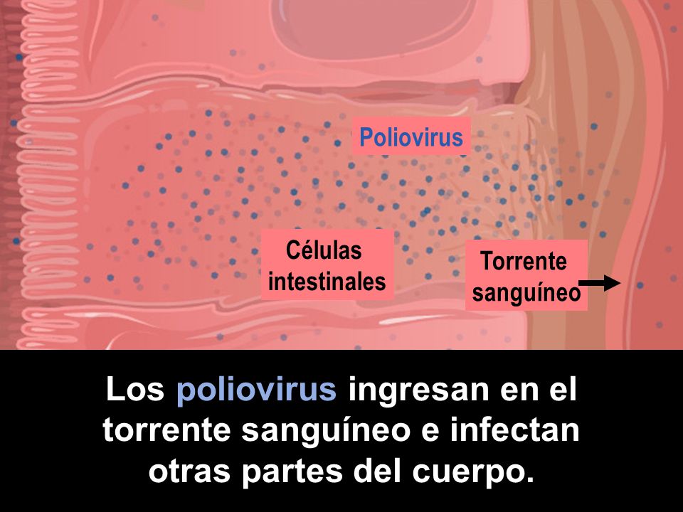 Los poliovirus ingresan en el torrente sanguíneo e infectan