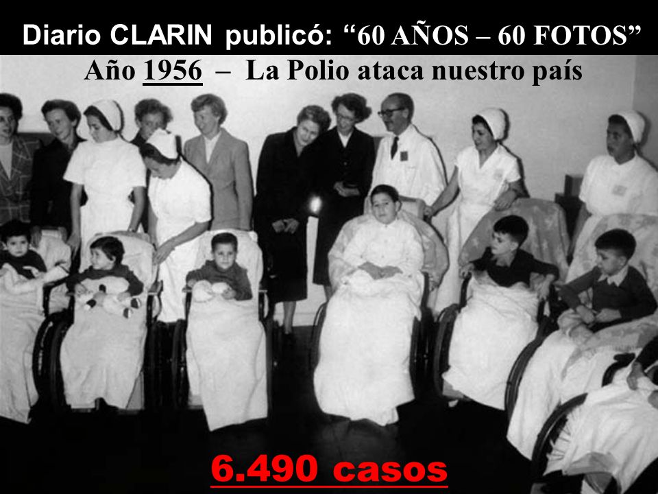 6.490 casos Año 1956 – La Polio ataca nuestro país