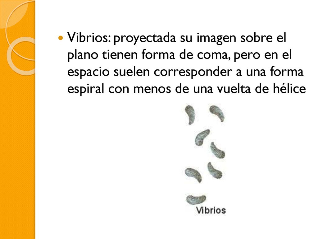 Vibrios: proyectada su imagen sobre el plano tienen forma de coma, pero en el espacio suelen corresponder a una forma espiral con menos de una vuelta de hélice