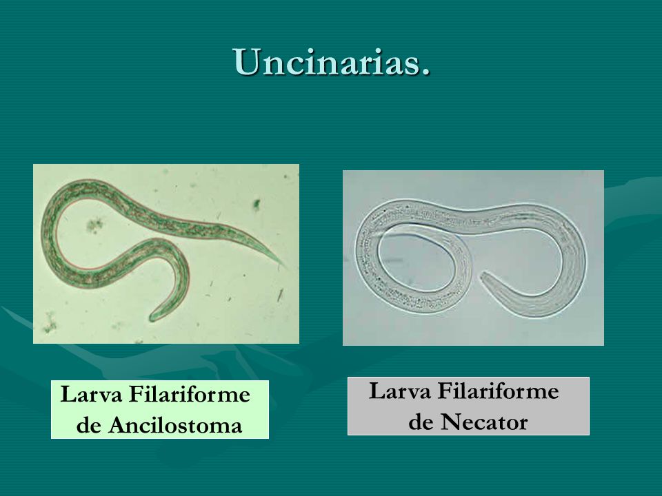 Uncinarias. Larva Filariforme Larva Filariforme de Necator