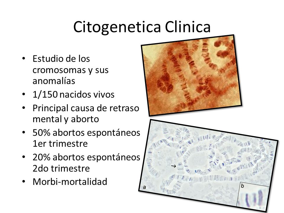 Citogenetica Clinica Estudio de los cromosomas y sus anomalías