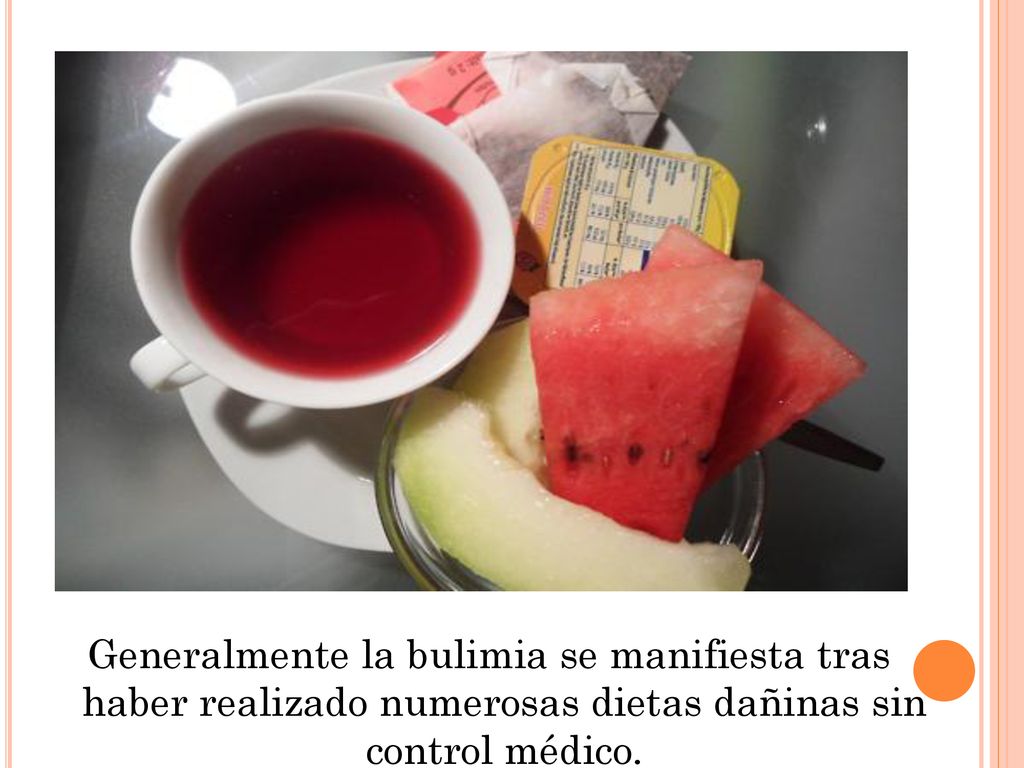Generalmente la bulimia se manifiesta tras haber realizado numerosas dietas dañinas sin control médico.