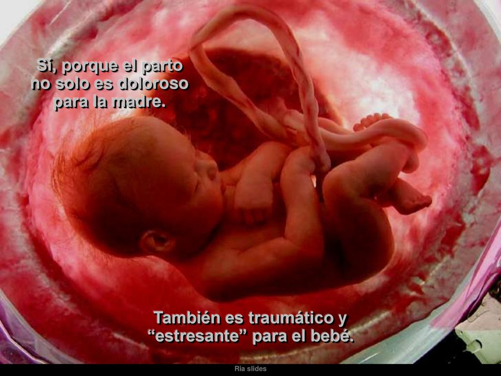 Sí, porque el parto no solo es doloroso para la madre.