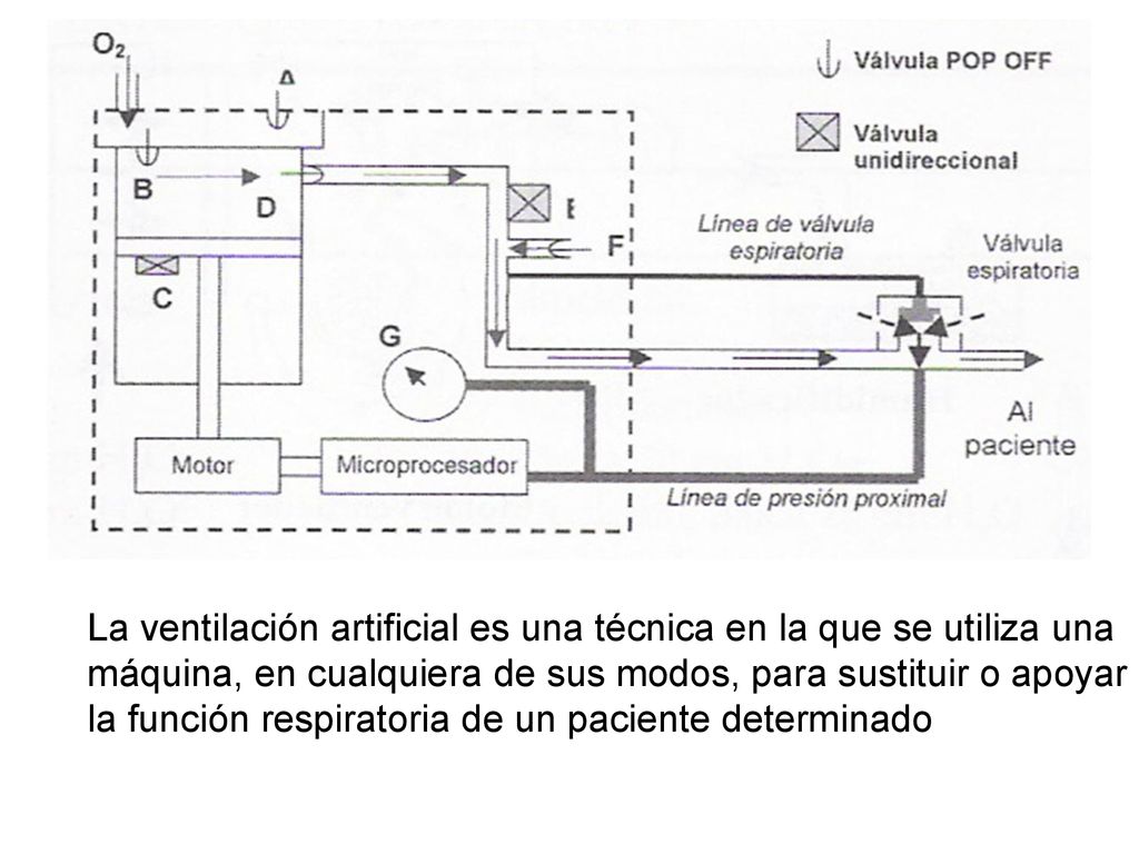 La ventilación artificial es una técnica en la que se utiliza una máquina, en cualquiera de sus modos, para sustituir o apoyar la función respiratoria de un paciente determinado