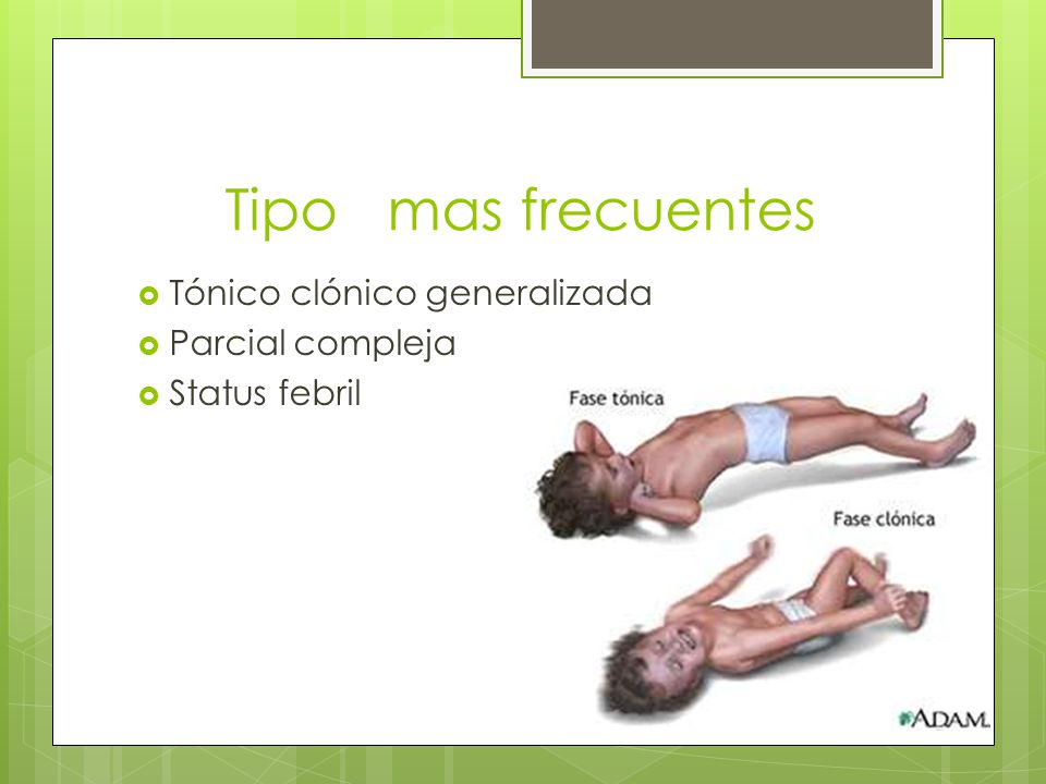 Tipo mas frecuentes Tónico clónico generalizada Parcial compleja