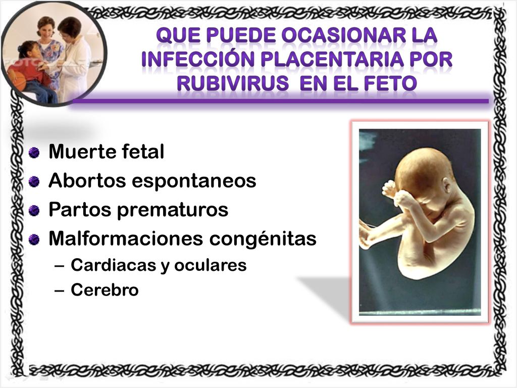 QUE PUEDE OCASIONAR La infección placentaria por rubivirus EN EL FETO