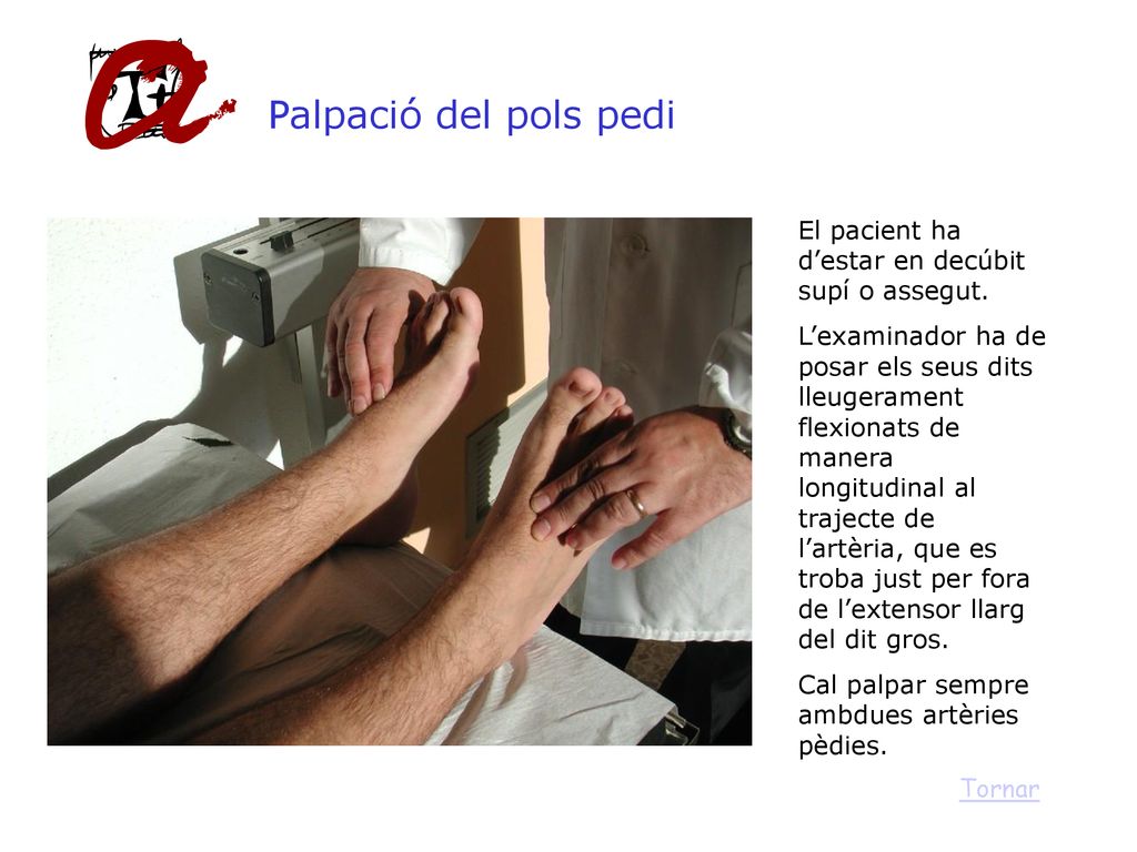Palpació del pols pedi El pacient ha d’estar en decúbit supí o assegut.