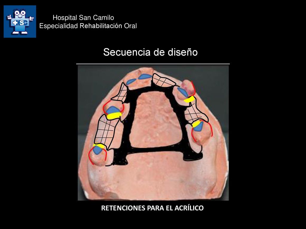 Secuencia de diseño RETENCIONES PARA EL ACRÍLICO Hospital San Camilo