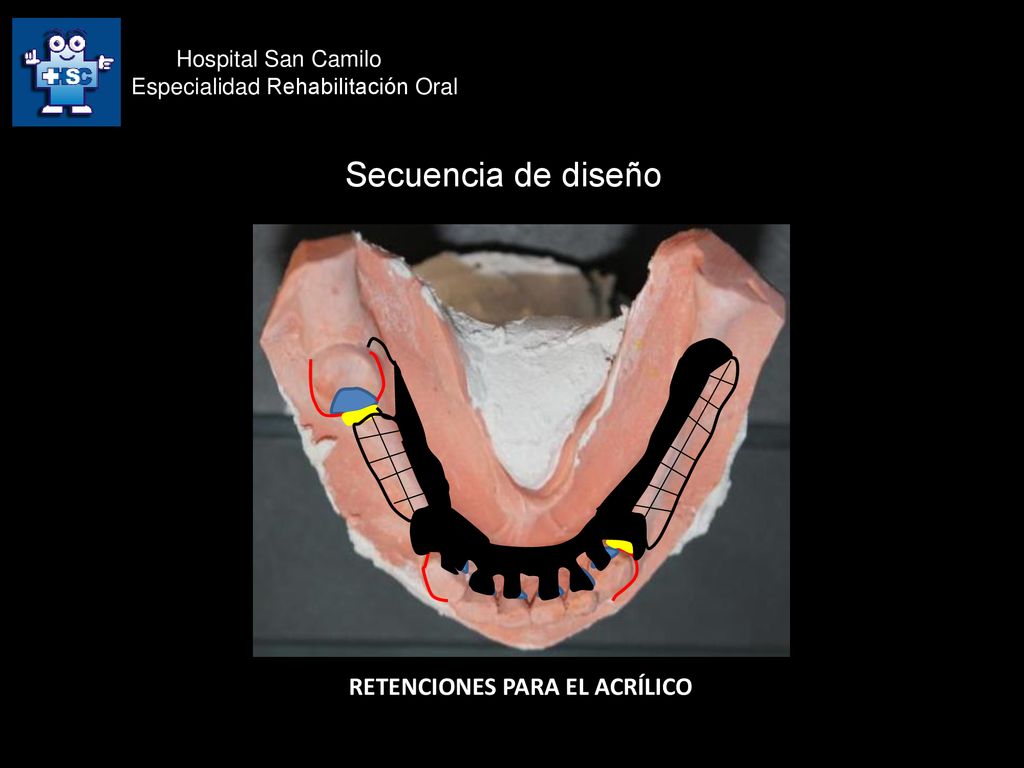 Secuencia de diseño RETENCIONES PARA EL ACRÍLICO Hospital San Camilo