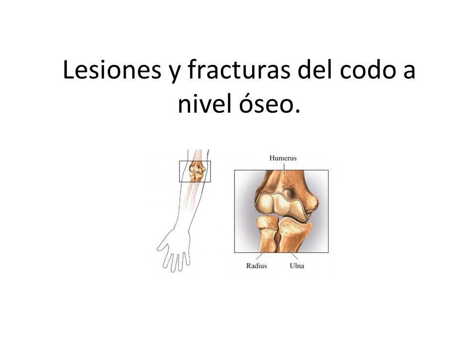 Lesiones y fracturas del codo a nivel óseo.