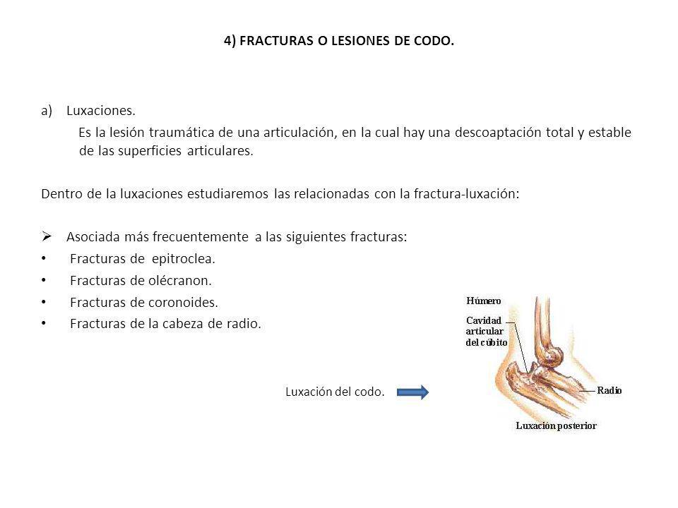 4) FRACTURAS O LESIONES DE CODO.