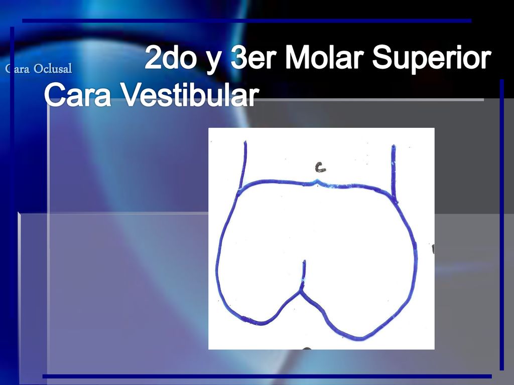2do y 3er Molar Superior Cara Vestibular Cara Oclusal