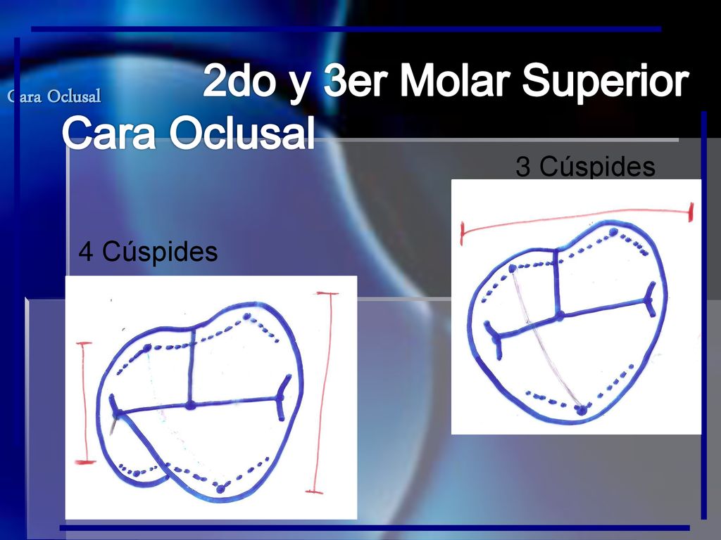 2do y 3er Molar Superior Cara Oclusal 3 Cúspides 4 Cúspides