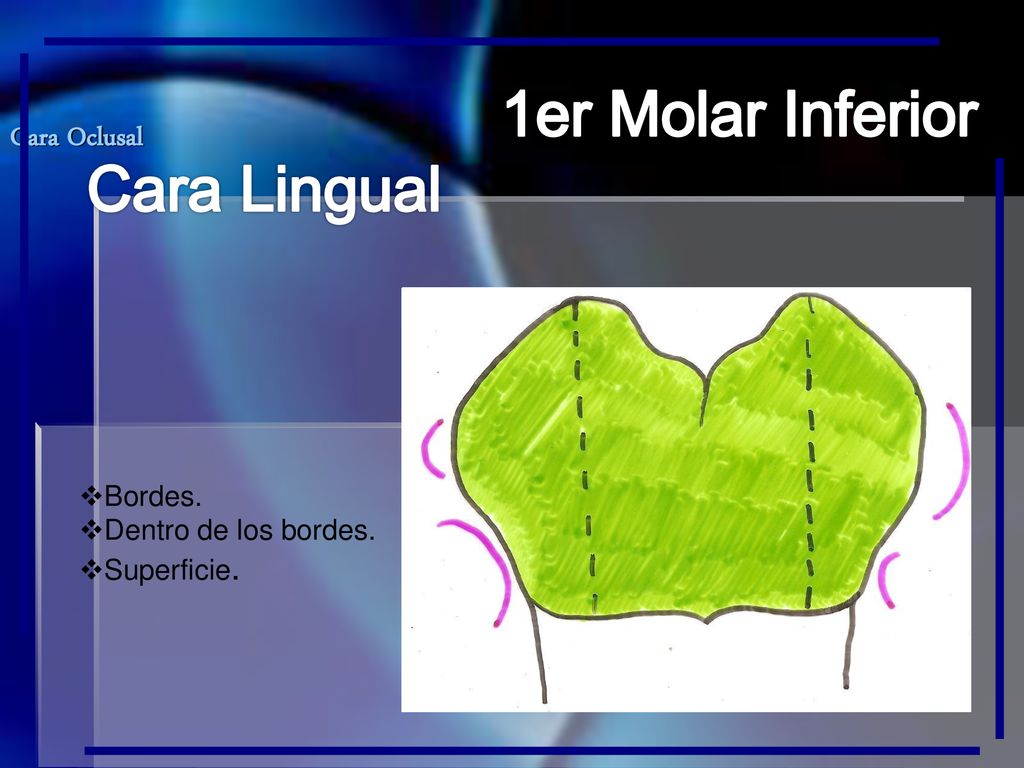 1er Molar Inferior Cara Lingual Cara Oclusal Bordes.