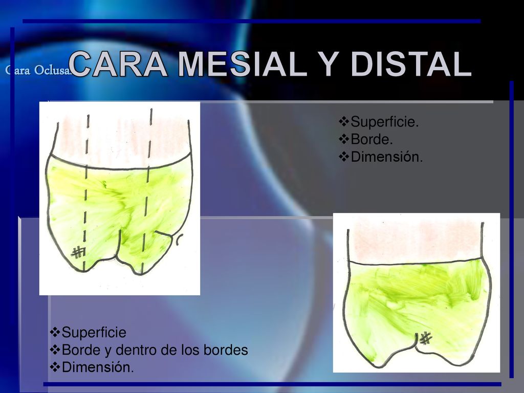 CARA MESIAL Y DISTAL Cara Oclusal Superficie. Borde. Dimensión.