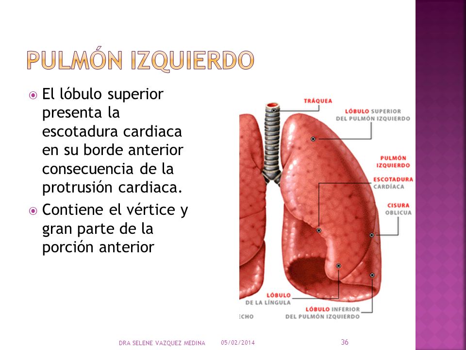 Pulmón izquierdo El lóbulo superior presenta la escotadura cardiaca en su borde anterior consecuencia de la protrusión cardiaca.