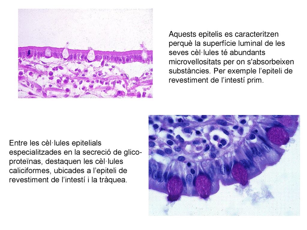 Aquests epitelis es caracteritzen perquè la superfície luminal de les seves cèl·lules té abundants microvellositats per on s absorbeixen substàncies. Per exemple l’epiteli de revestiment de l’intestí prim.