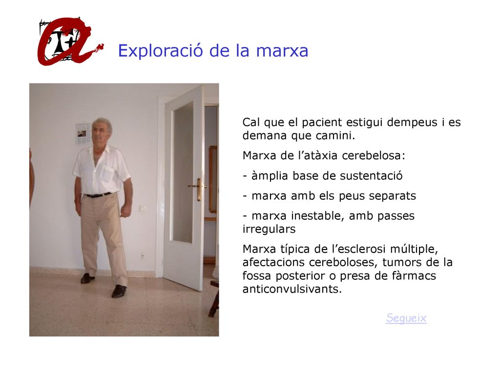 Exploració de la marxa Cal que el pacient estigui dempeus i es demana que camini. Marxa de l’atàxia cerebelosa: