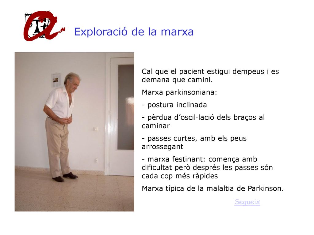 Exploració de la marxa Cal que el pacient estigui dempeus i es demana que camini. Marxa parkinsoniana: