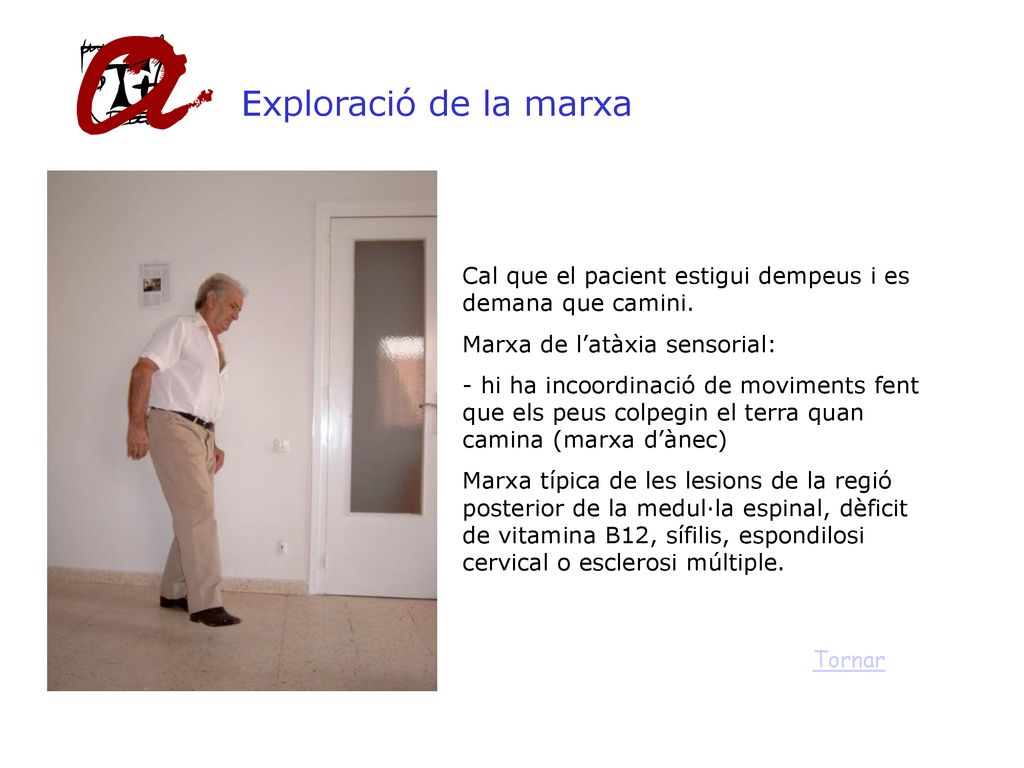 Exploració de la marxa Cal que el pacient estigui dempeus i es demana que camini. Marxa de l’atàxia sensorial: