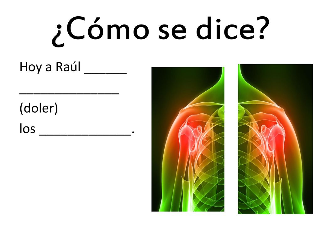 ¿Cómo se dice Hoy a Raúl ______ ______________ (doler) los _____________.