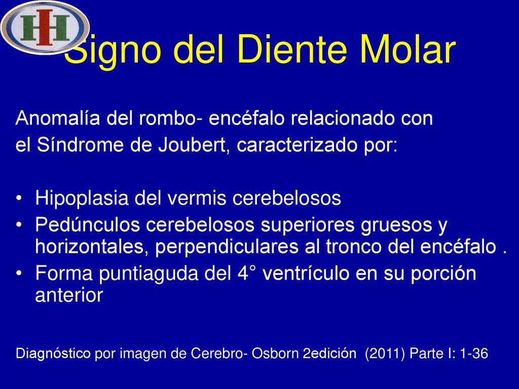Signo del Diente Molar Anomalía del rombo- encéfalo relacionado con